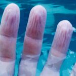 Dita raggrinzite in acqua