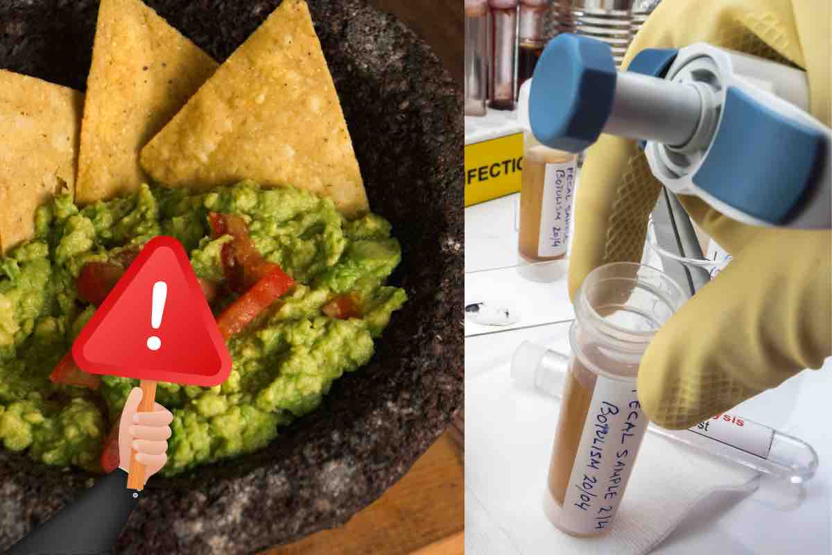 Botulismo nel guacamole